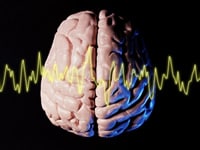 アイデアの出し方