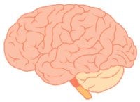 クモ膜下出血ってどんな病気？