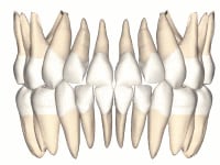 抜歯しても歯が残る!？歯の部分的な抜歯