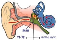 メニエール病ってどんな病気？原因症状は？