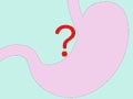 内視鏡では異常なし？ 「機能性胃腸症」