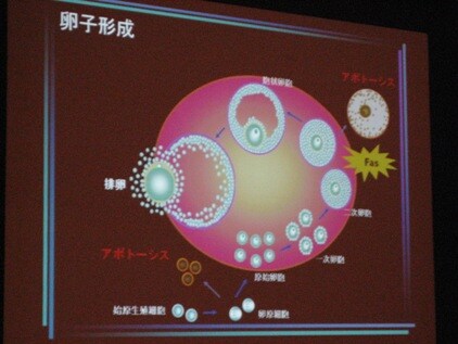 毛髪検査