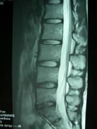 腰痛を簡単に考える方法　そもそも腰痛ってなんですか？
