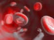 気になる生活習慣病を考えよう　高血圧薬を使う、その前に