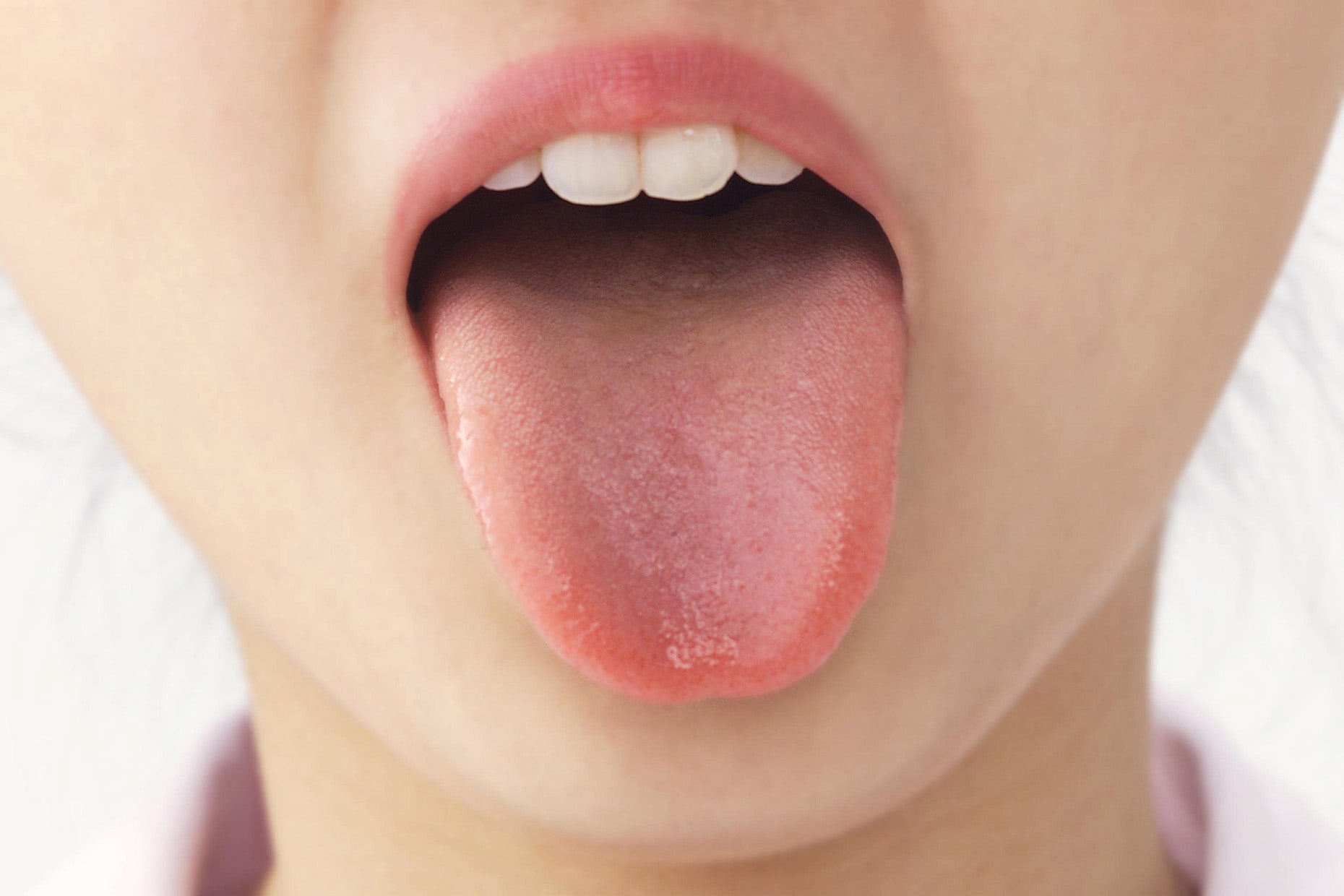 口腔アレルギー症候群とは？治療と対策