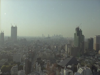 キレイ好きはNG？衛生環境でアトピー増加