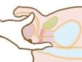 前立腺肥大症の症状・診断