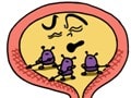膀胱の主な病気の診断法と治療法