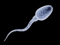 無精子症でも子どもができる？ 精巣精子採取法(TESE)