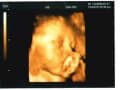 妊娠28週 逆子は治る？エコー写真・胎児の体重や大きさ