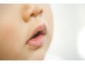 子どもの口腔カンジダ症・鵞口瘡(がこうそう)はうつる？症状と治療法