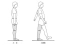 理学療法士(PT)試験（義肢装具学）の問題傾向