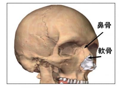 鼻骨骨折の症状・診断・治療 [骨・筋肉・関節の病気] All About