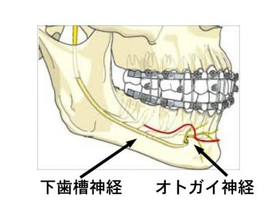 下顎骨骨折の症状・診断・治療