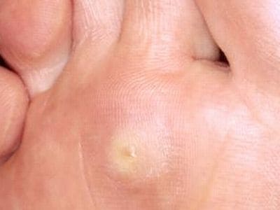 主な皮膚の病気一覧・症例画像【医師が解説】 [皮膚・爪・髪の ...