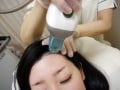 薄毛女性の救世主！レーザーで育毛治療