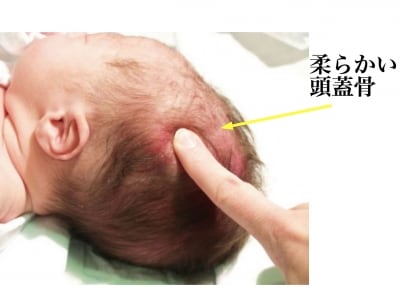 くる病の症状・診断・治療 子供の病気 All About