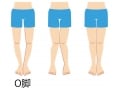 O脚を直して美しい踊りを手に入れよう！