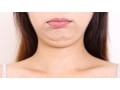 二重アゴを即解消!? BNLS注射で今すぐ小顔に