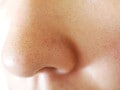 毛穴のぶつぶつを無くすには？毛穴レス肌に変わる秘策