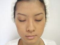 STEP1