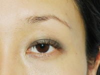 Before