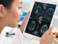 若年性認知症が30年で2倍に？ 40歳から急増する早期発症型アルツハイマー病のリスク要因と予防法