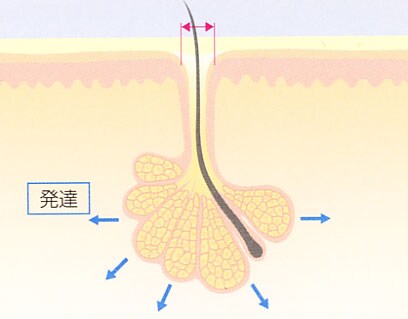 毛穴思春期
